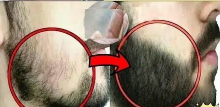 ঘরোয়া উপায়ে ঘন দাড়ি গজানোর সহজ নিয়ম