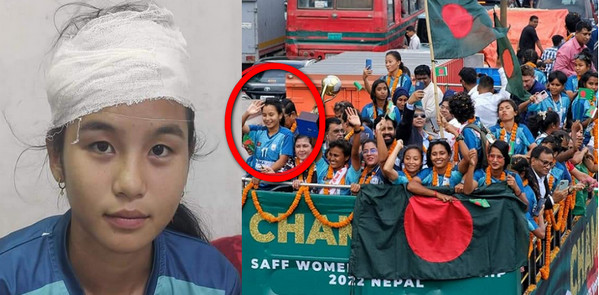 ঋতুপর্ণার মাথায় তিনটি সেলাই