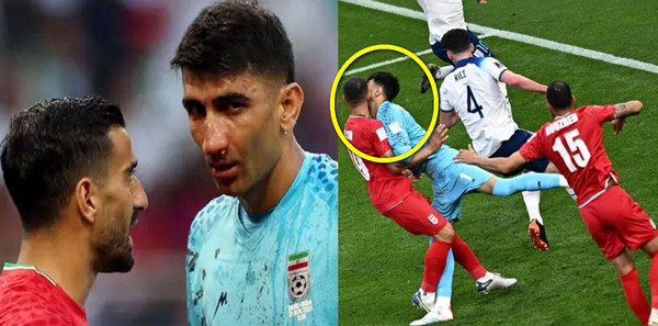 ম্যাচ শেষে জানা গেল যে কারনে মাথায় আঘাত পাওয়ার পরও প্রথমে মাঠ ছাড়েননি ইরান গোলরক্ষক