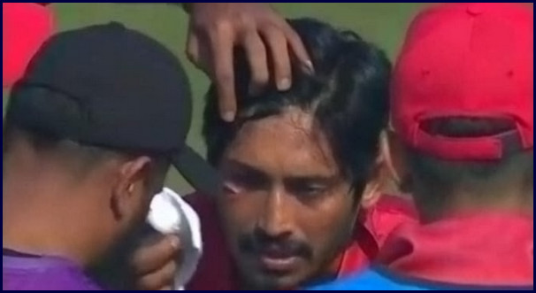 খেলা চলাকালীন সময়ে মুখ ফেটে রক্ত ঝরল বিজয়ের