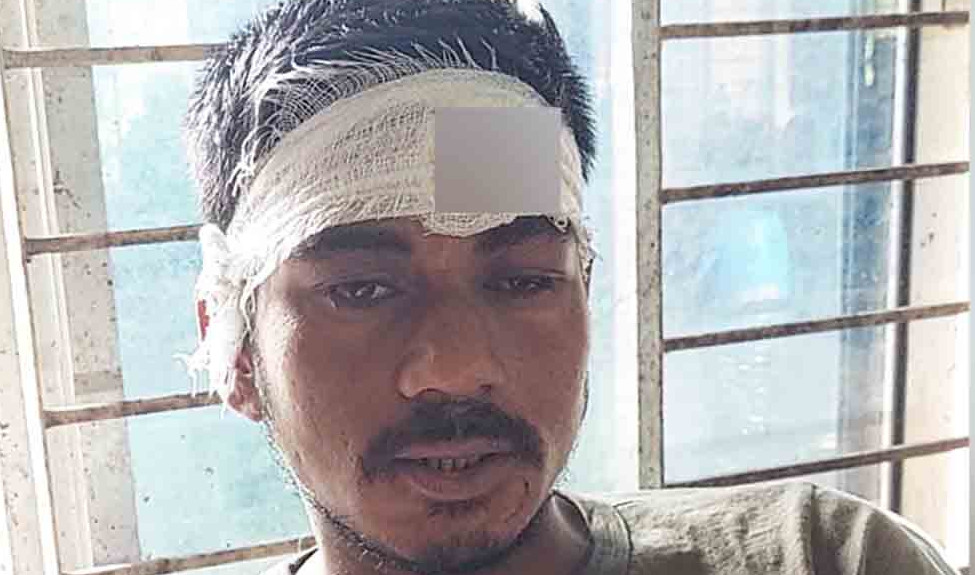 সিগারেটের দাম নিয়ে মারামারি শুরু