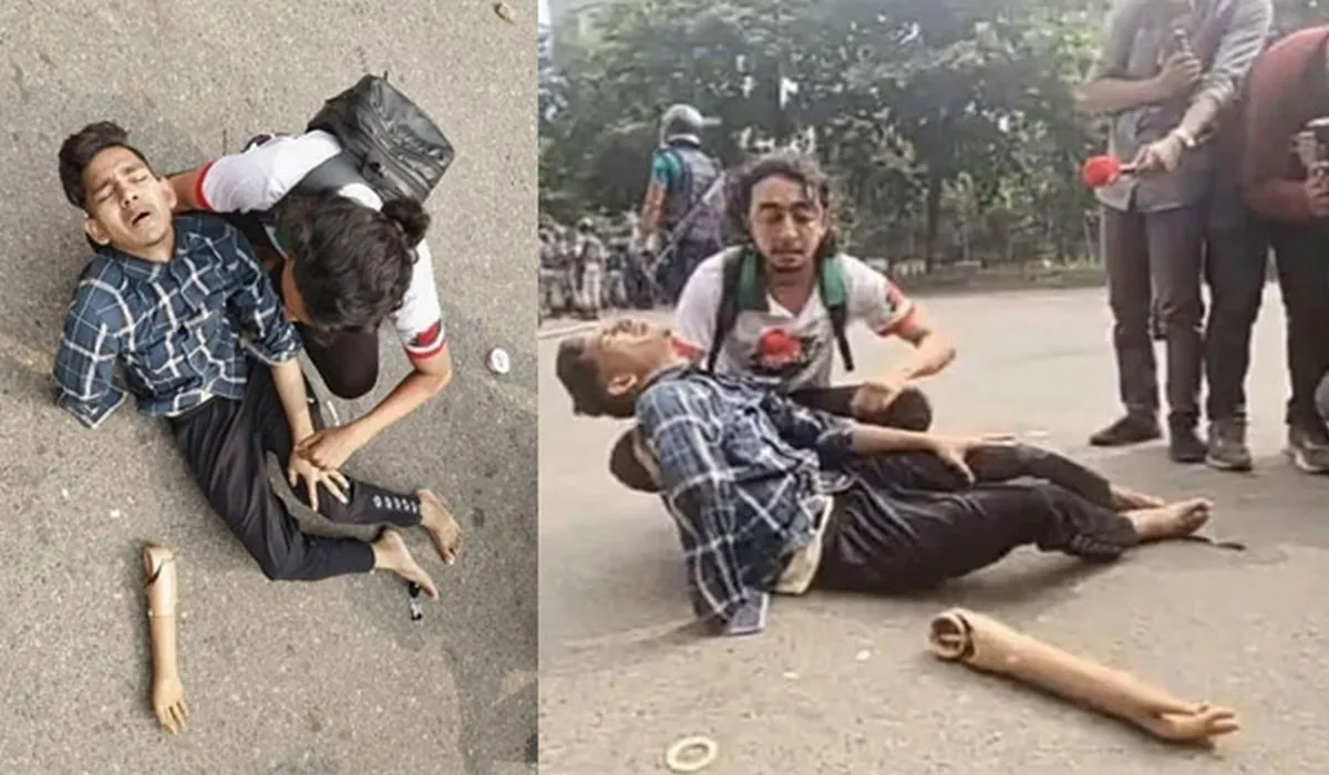 রাজধানীতে উত্তেজনা: আহত জুলাইযোদ্ধার কৃত্রিম হাত পড়ে থাকলো রাস্তায়