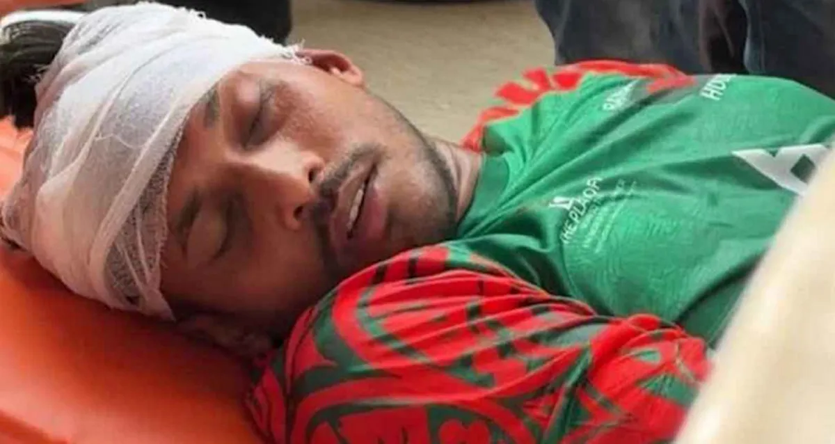 ম্যাচের মধ্যেই রক্তাক্ত বাংলাদেশের খেলোয়ার, নেওয়া হয়েছে হাসপাতালে