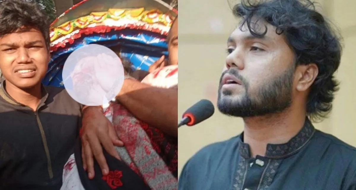 ওসমান হাদিকে নিয়ে ‘দুঃসংবাদ’ দিলো মেডিকেল বোর্ড