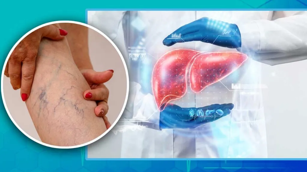 লিভার খারাপ হলে আগে সতর্ক সংকেত দেয় ত্বক— জেনেনিন লক্ষণগুলো