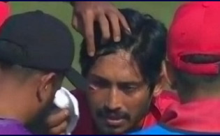 খেলা চলাকালীন সময়ে মুখ ফেটে রক্ত ঝরল বিজয়ের