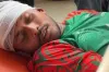 ম্যাচের মধ্যেই রক্তাক্ত বাংলাদেশের খেলোয়ার, নেওয়া হয়েছে হাসপাতালে
