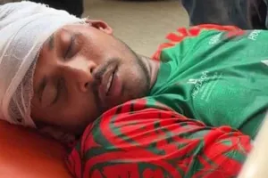 ম্যাচের মধ্যেই রক্তাক্ত বাংলাদেশের খেলোয়ার, নেওয়া হয়েছে হাসপাতালে